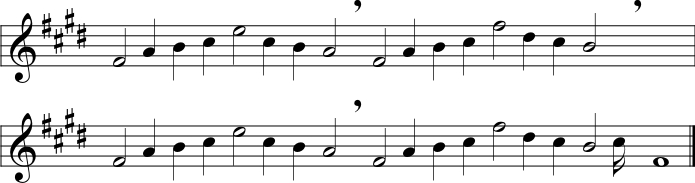 Parlando notation for the simple melody